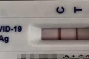 新冠 阳后有必要拍肺部CT吗